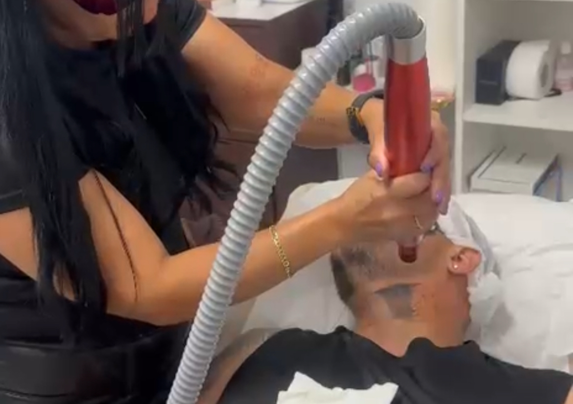 Espalda : Carbon Peel + Facial