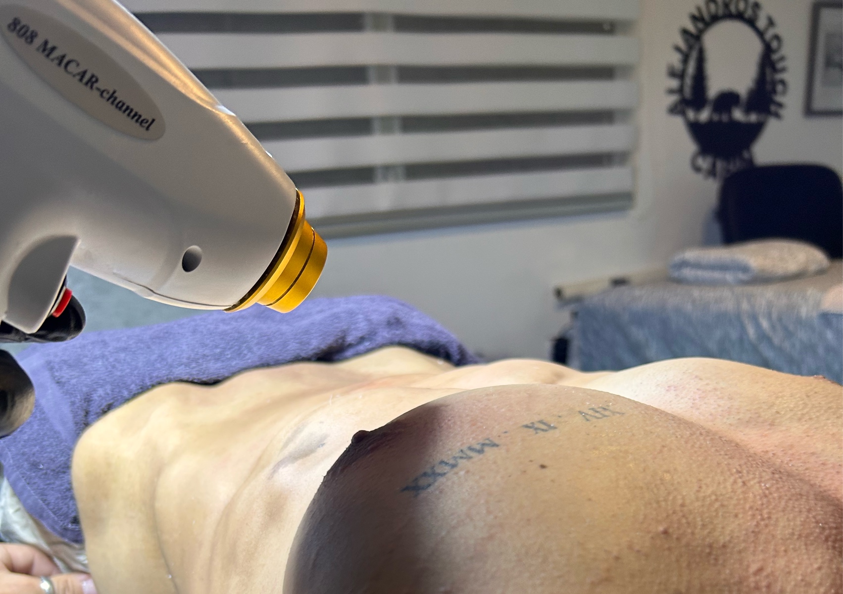7 sesiones depilacion laser Brazillian