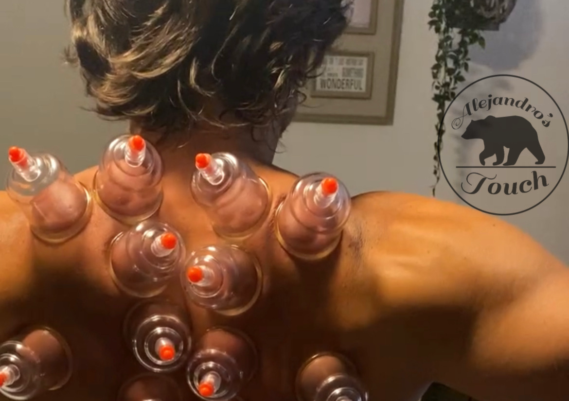 Cupping/ ventosas
