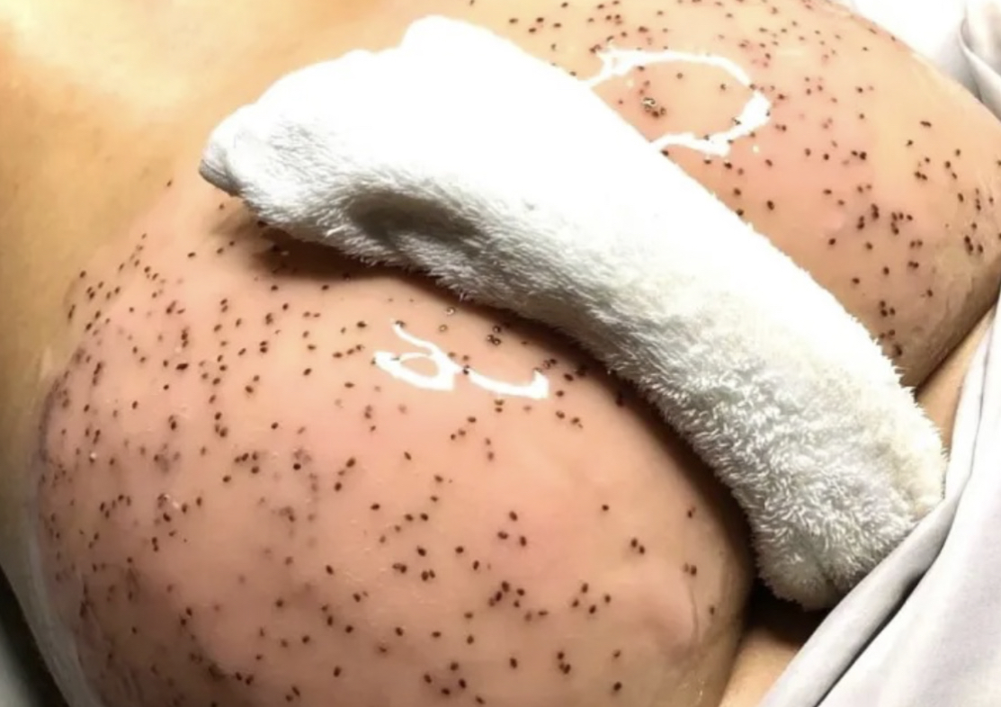Booty Facial