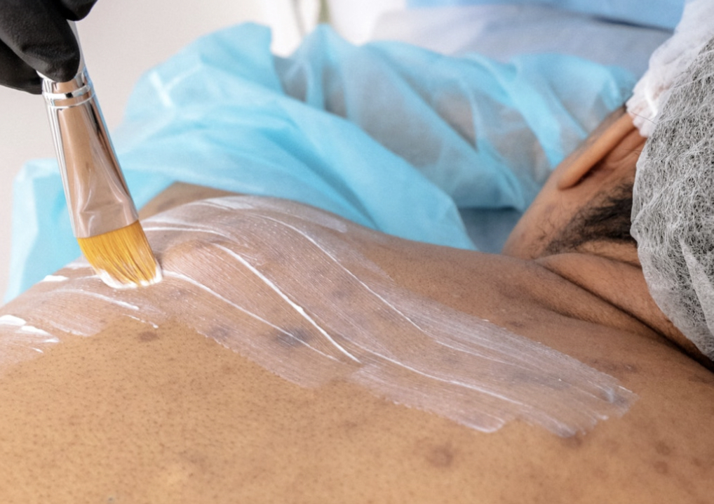 Back Facial