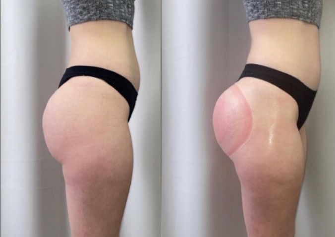 Booty Sculpt & Lift