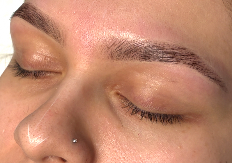 Full brow transformation 