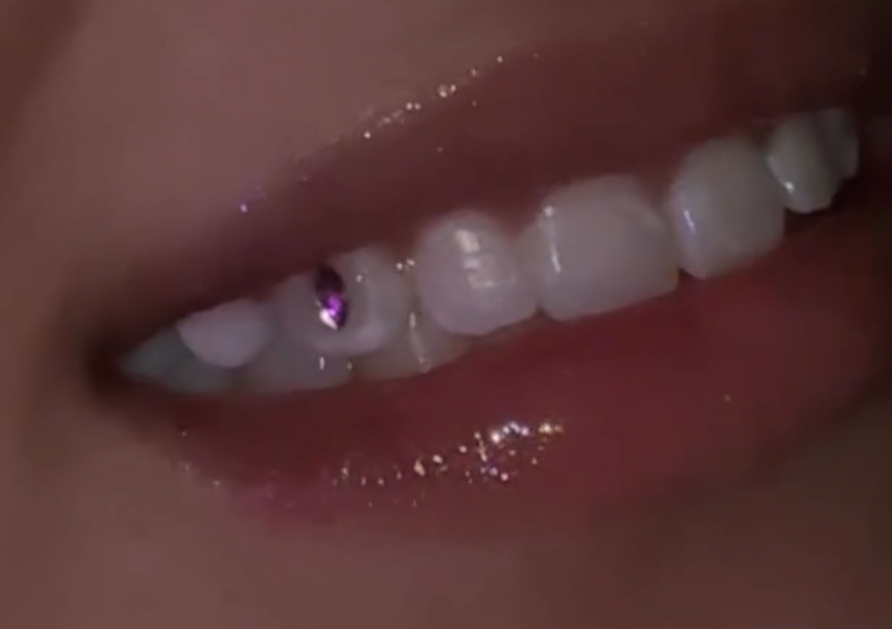 Teeth gems 
