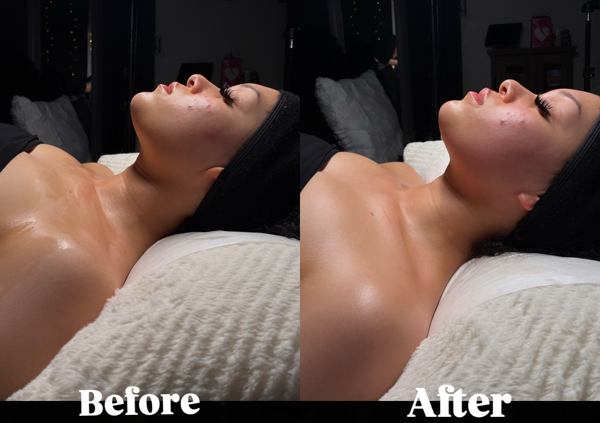 Full body Lymphatic drainage 