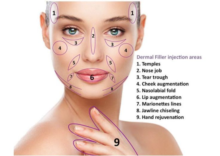 Dermal Filler