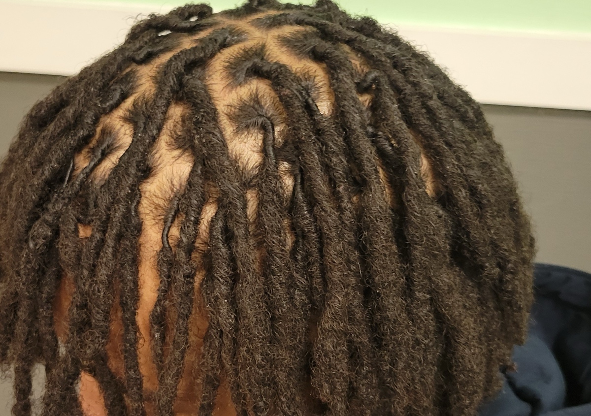 Retwist