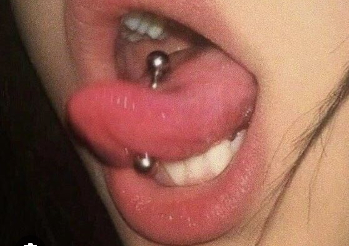 Tongue piercing 