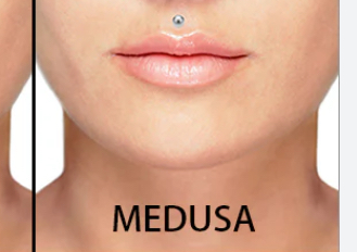 Medusa piercing 