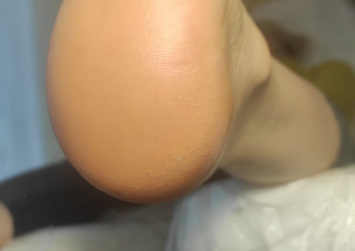 Hygienic dry pedicure (express) 