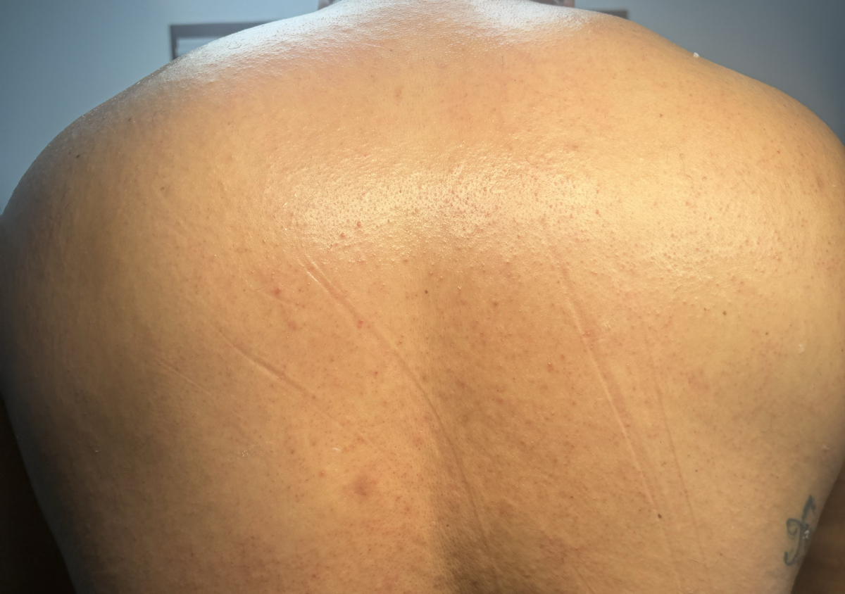 Back wax  (2/2)
