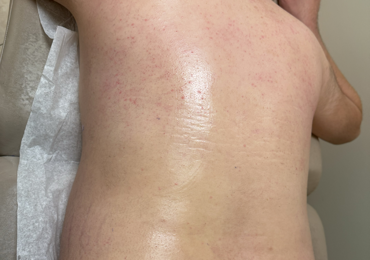 Back wax  (1/2)