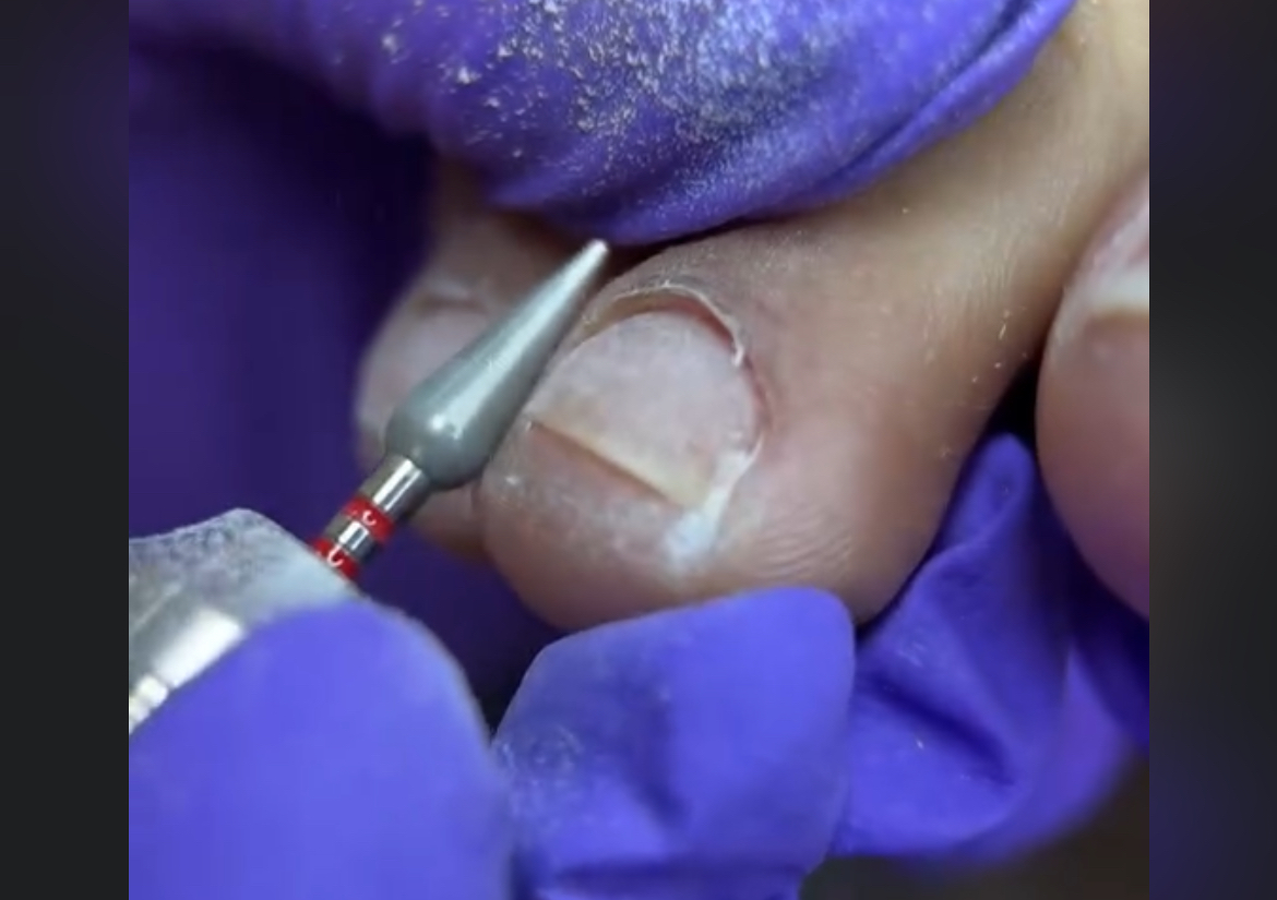 Russian technique (pedicure)