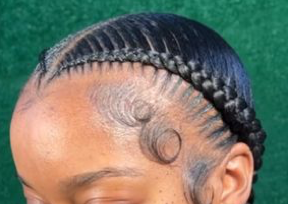2 scalp stitch braids 