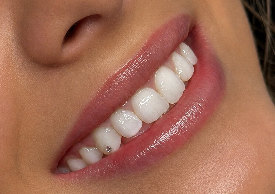1x Swarovski tooth gem 