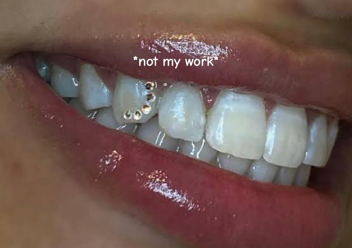 5x Swarovski tooth gem 