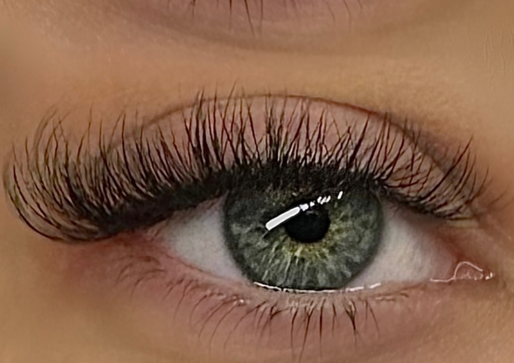 Light volume infills