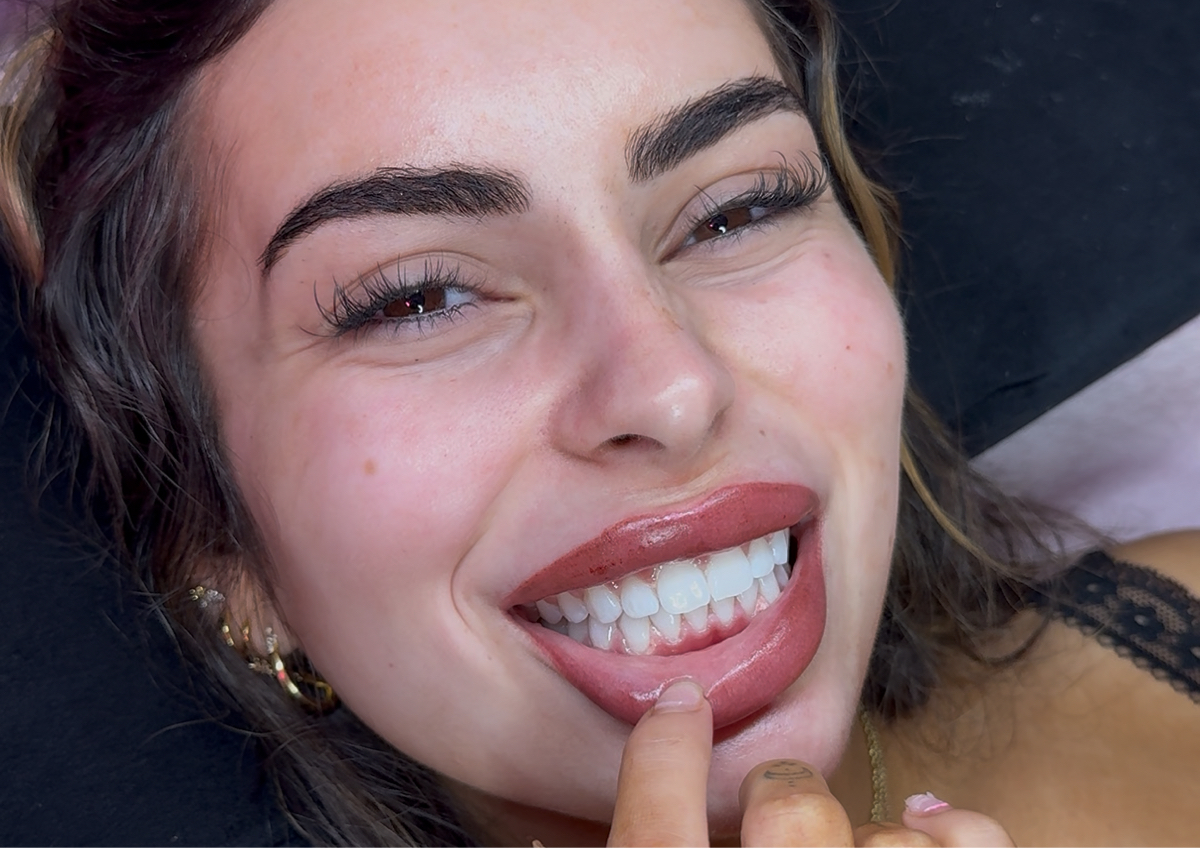 30 minute express Teeth Whitening 