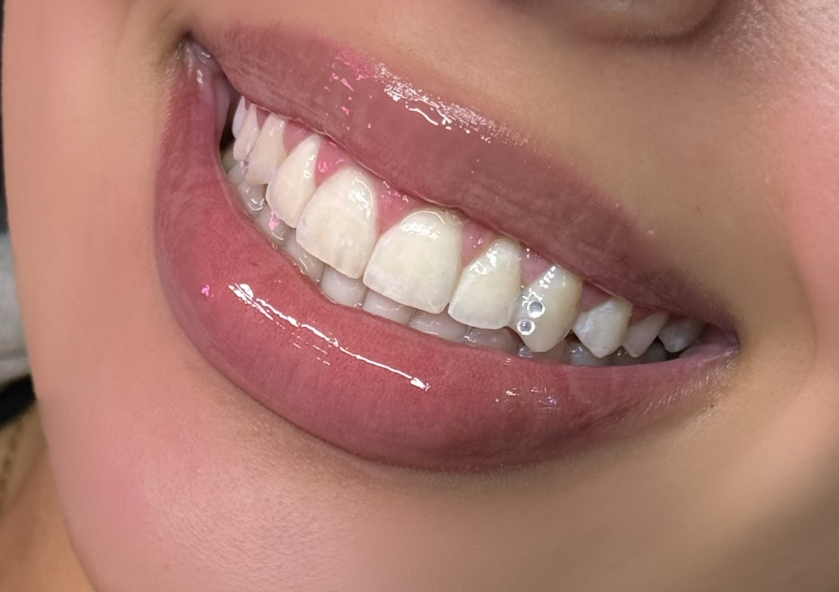 2x Swarovski tooth gem 