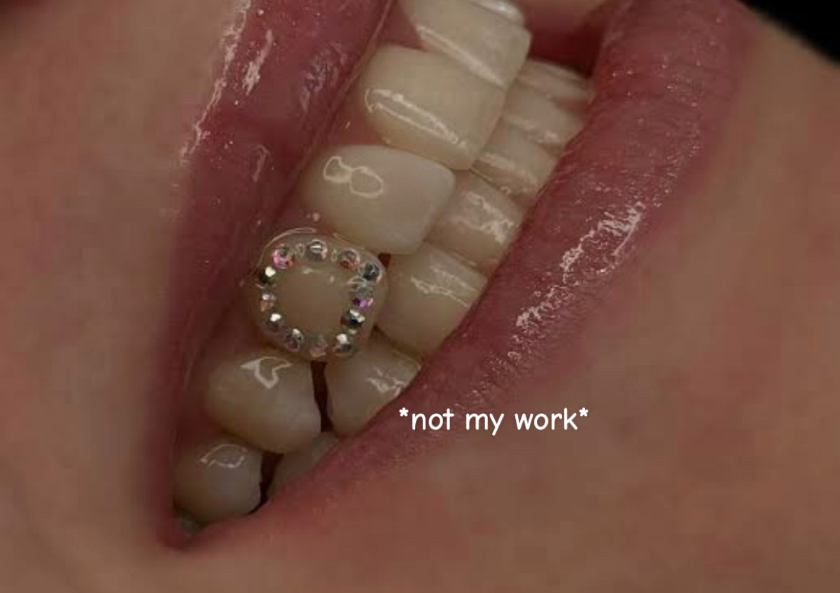 Swarovski window tooth