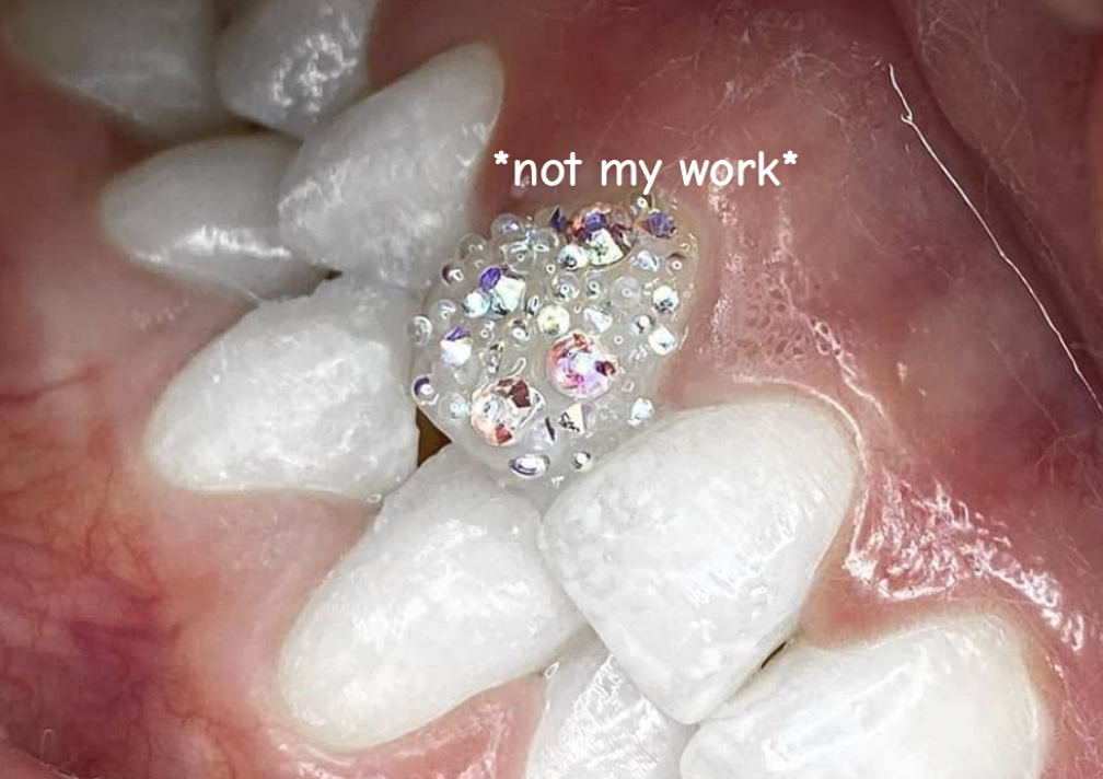 Swarovski chandelier tooth