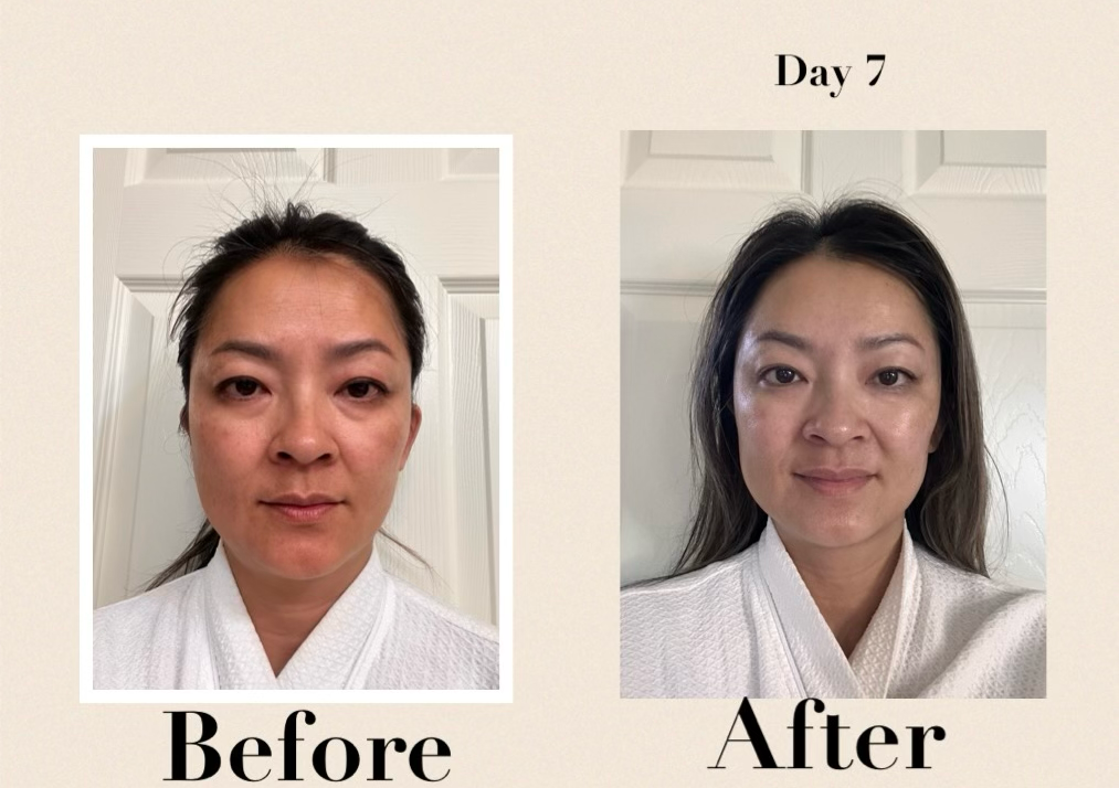 Green Sea Peel Series