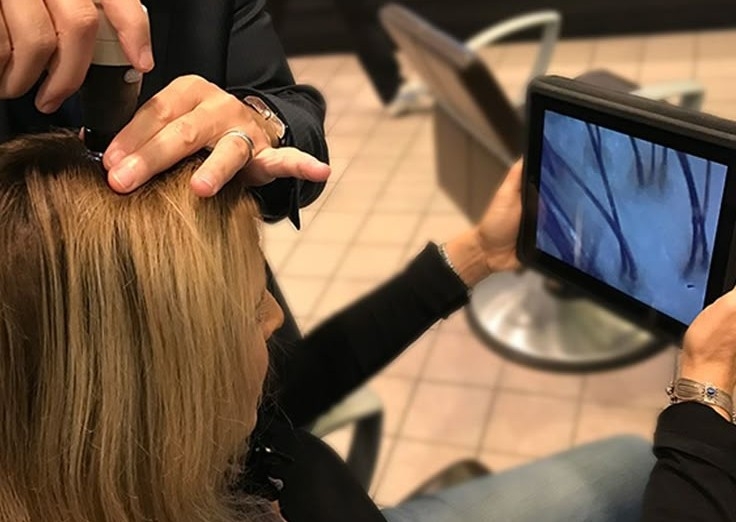 Hairloss and  Scalp consultation 