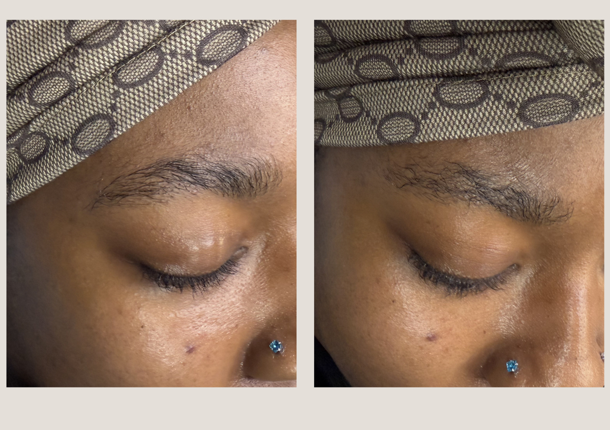 Eyebrow Lamination 