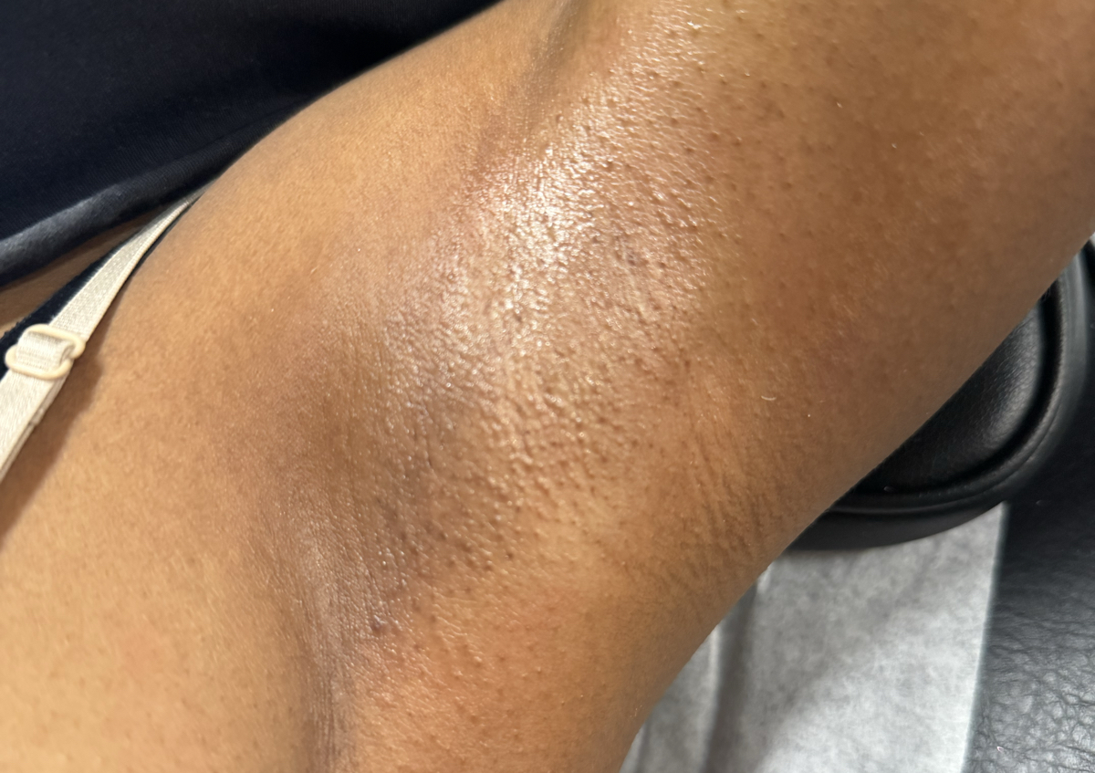 Under Arm Wax