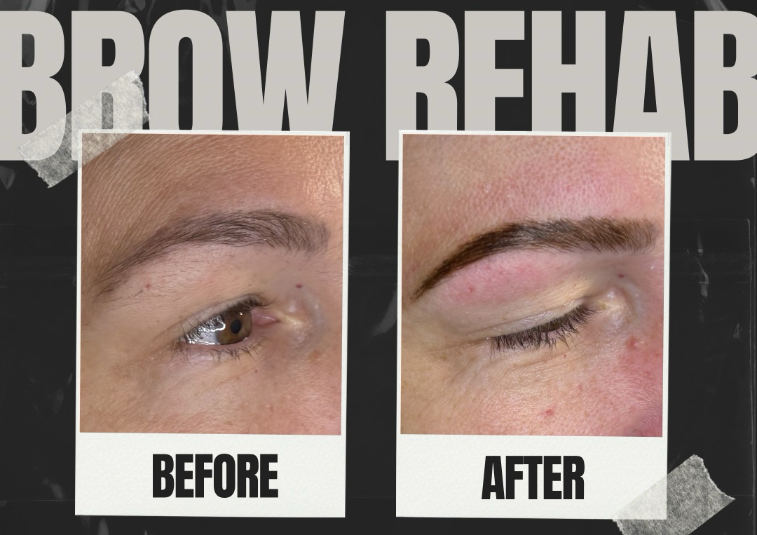 Brow Rehab