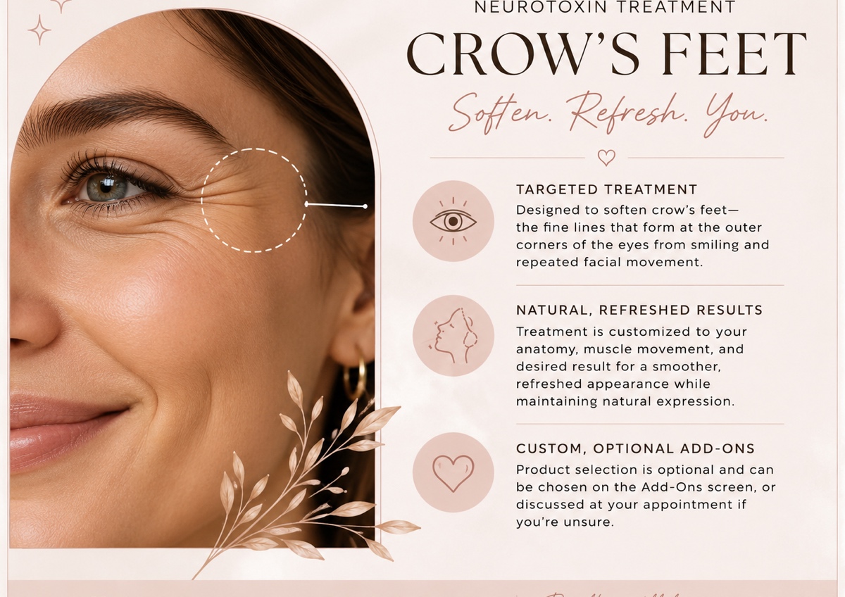 Crows Feet