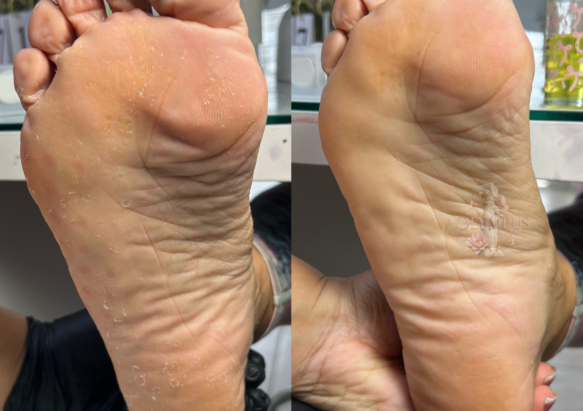 Pedicura sola (sin esmaltado) 