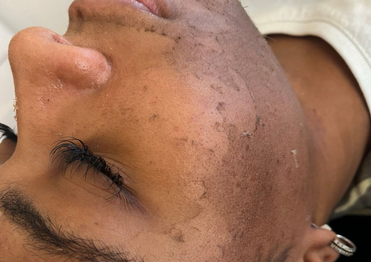 The Perfect Derma
