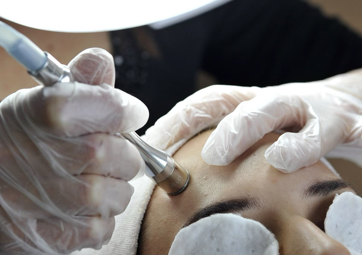 Microdermabrasion Facial ✨