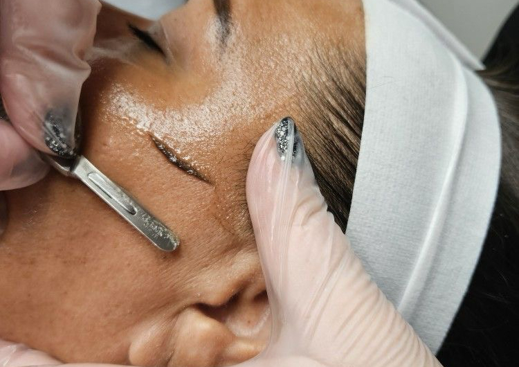 Dermaplaning Detox 