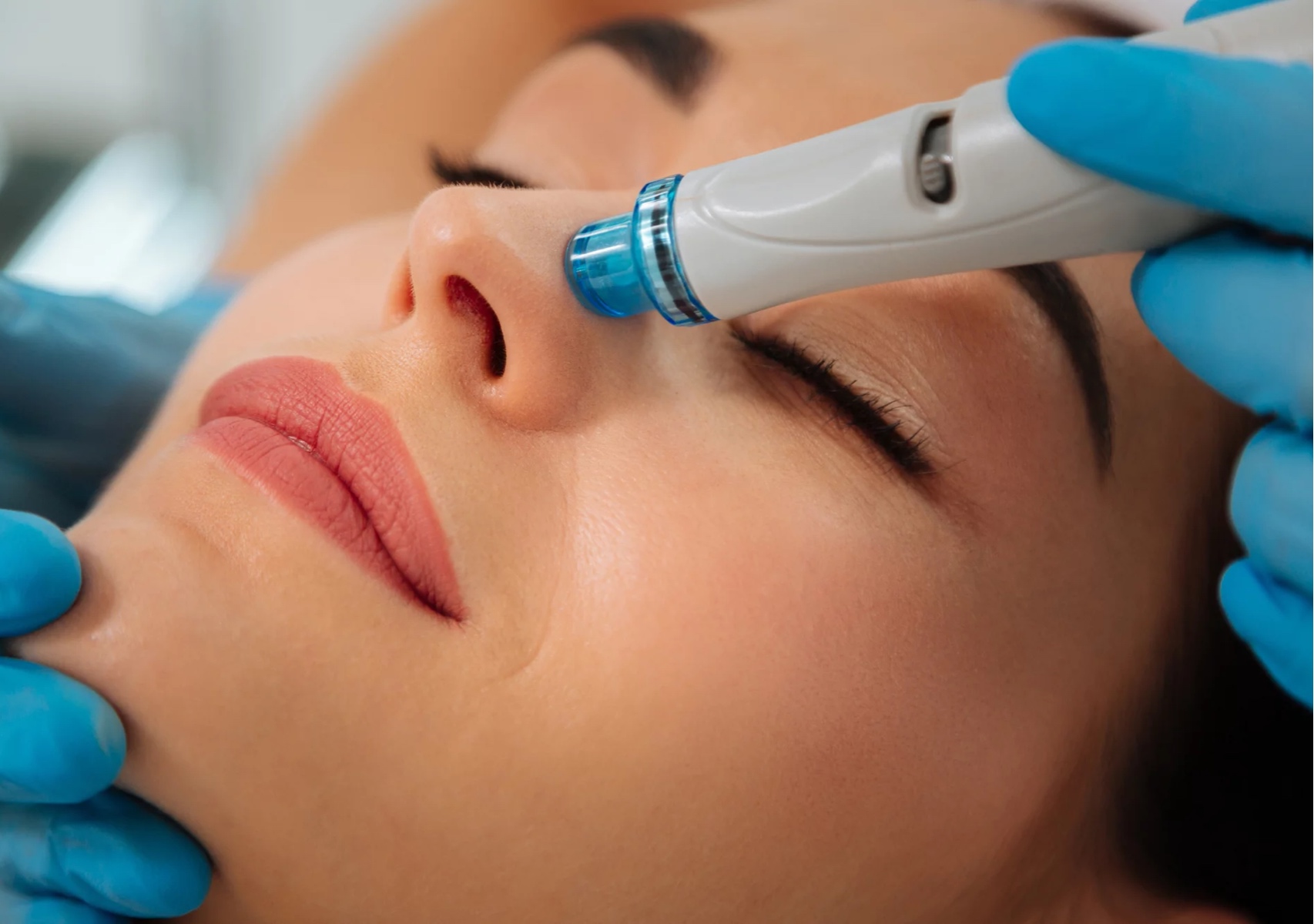 Hydrafacial / Hidrafacial 