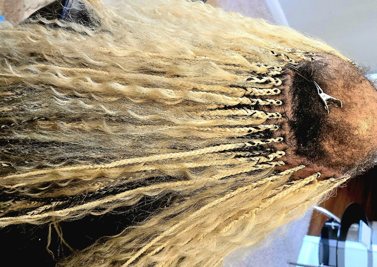 Alopecia hair braids