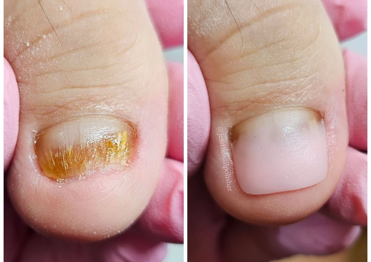 Polygel big Toes
