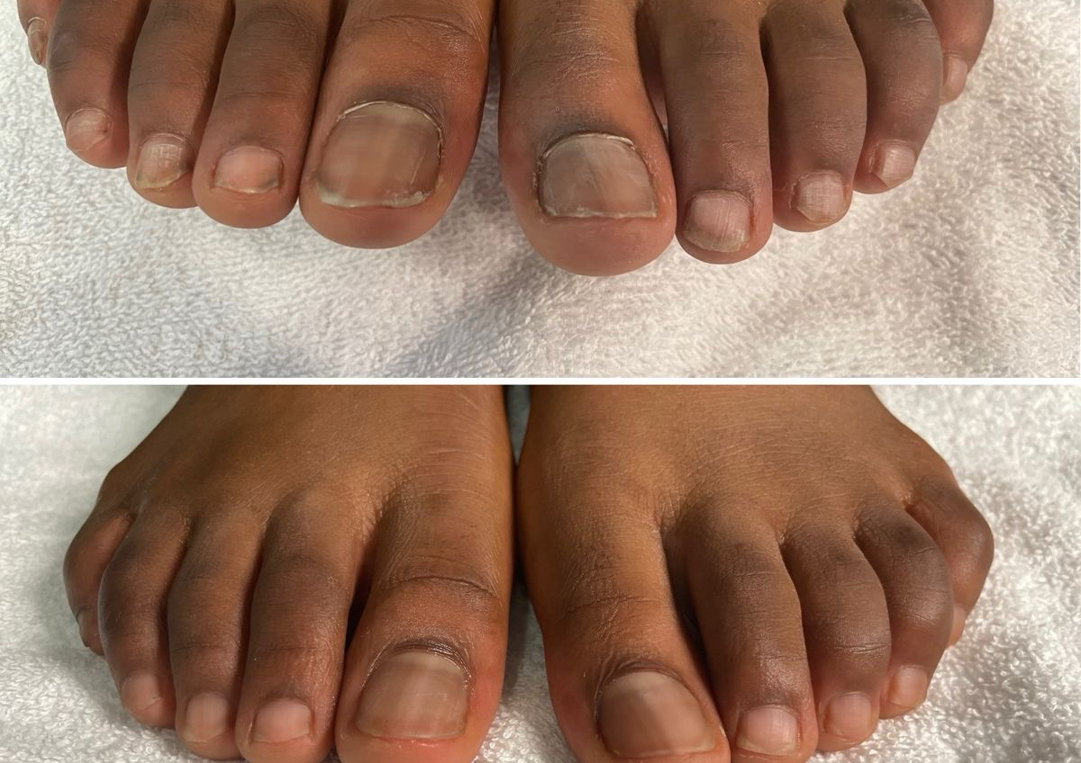 Male pedicure