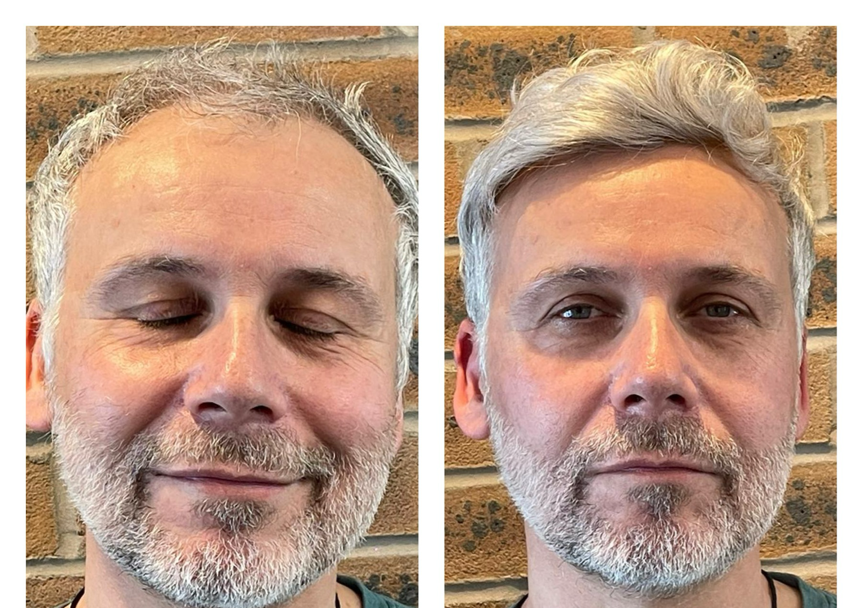 Hair system consultation 