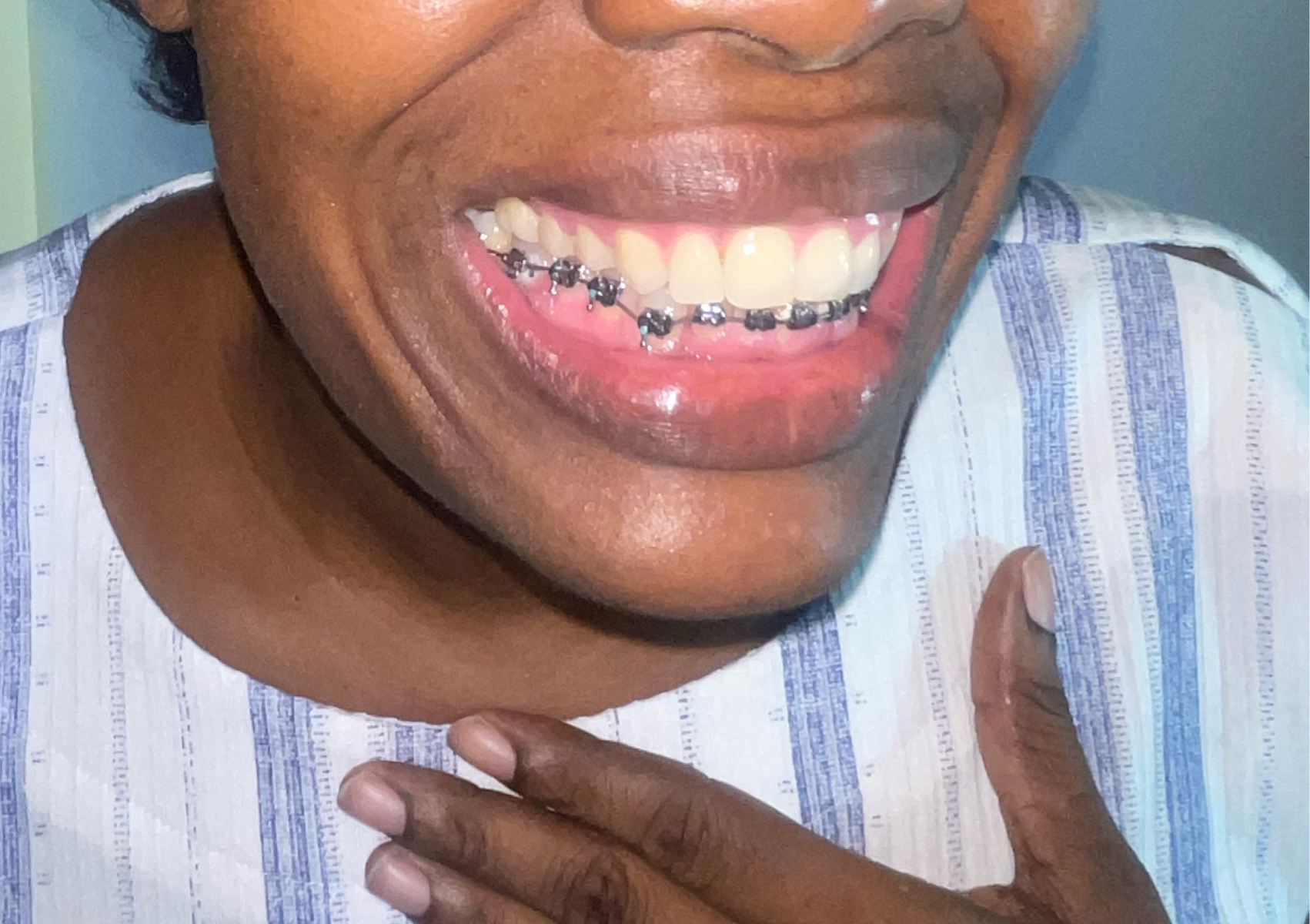 (One Row) Authentic Installation