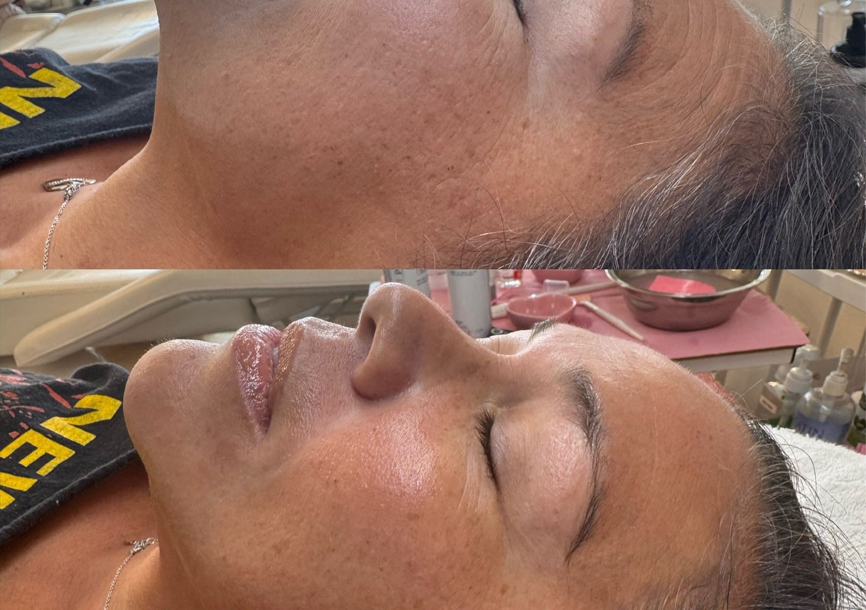 The Firmimg Peptide Treatment 