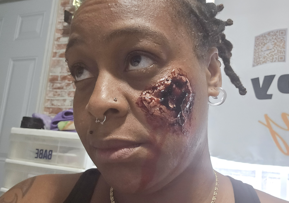 Large Facial Wound 