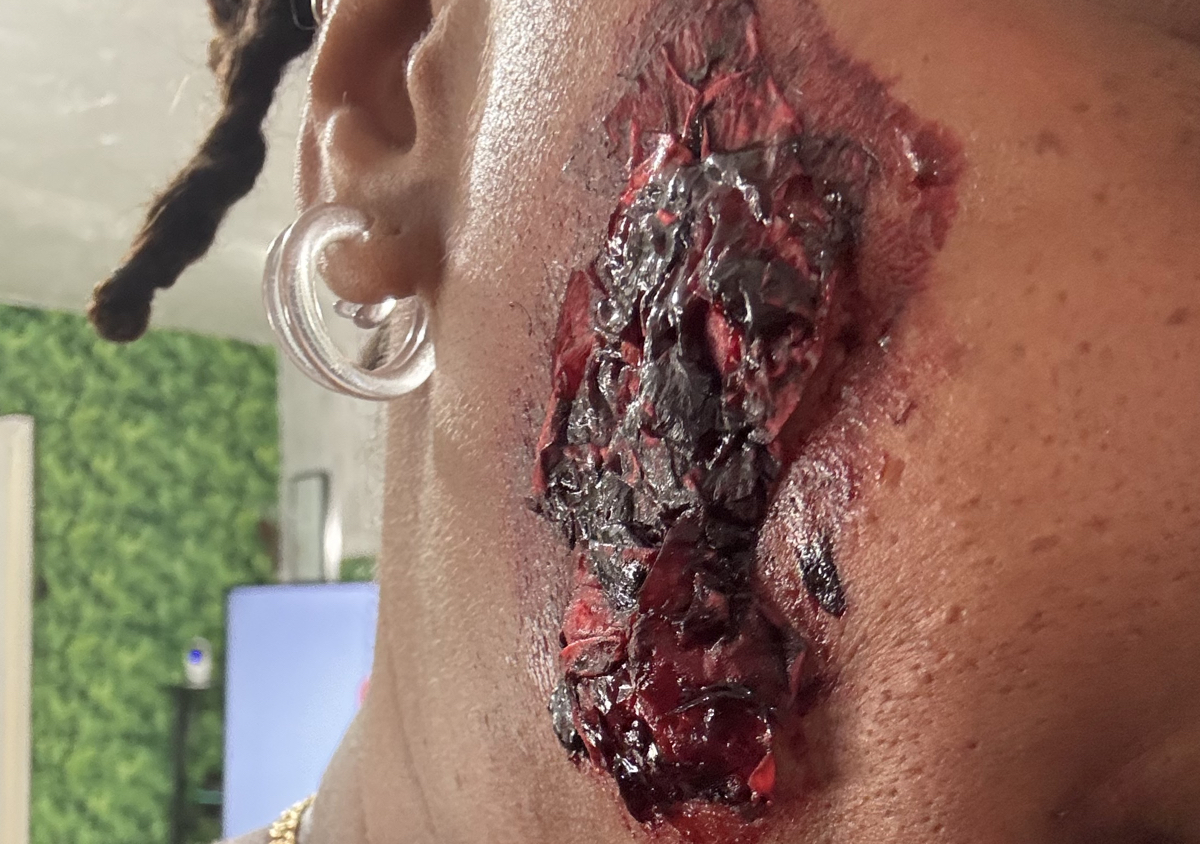 Burn Effects 