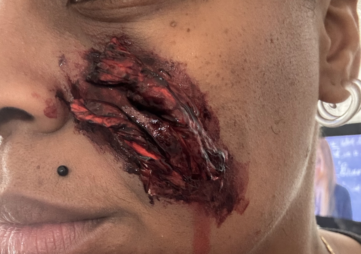 Large or Detailed Scar 