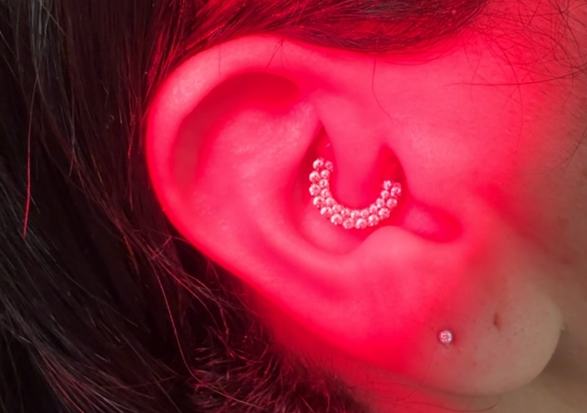 Laserterapia  ( 4 sessoes) 