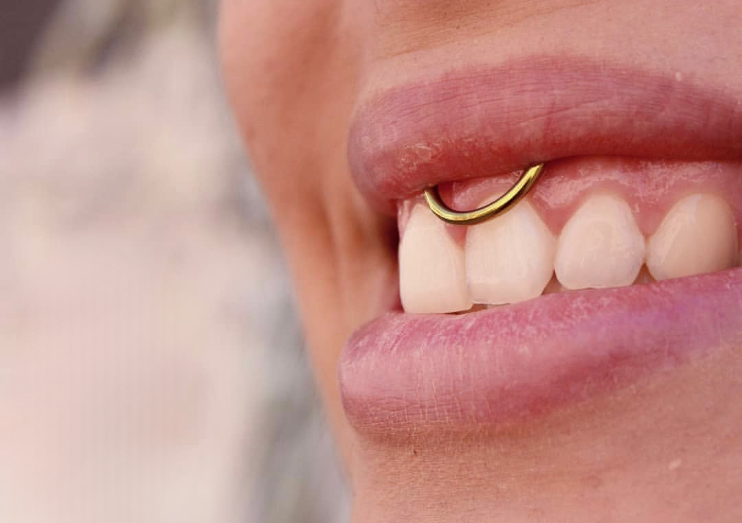 Freio | Labial Frenulum 18+
