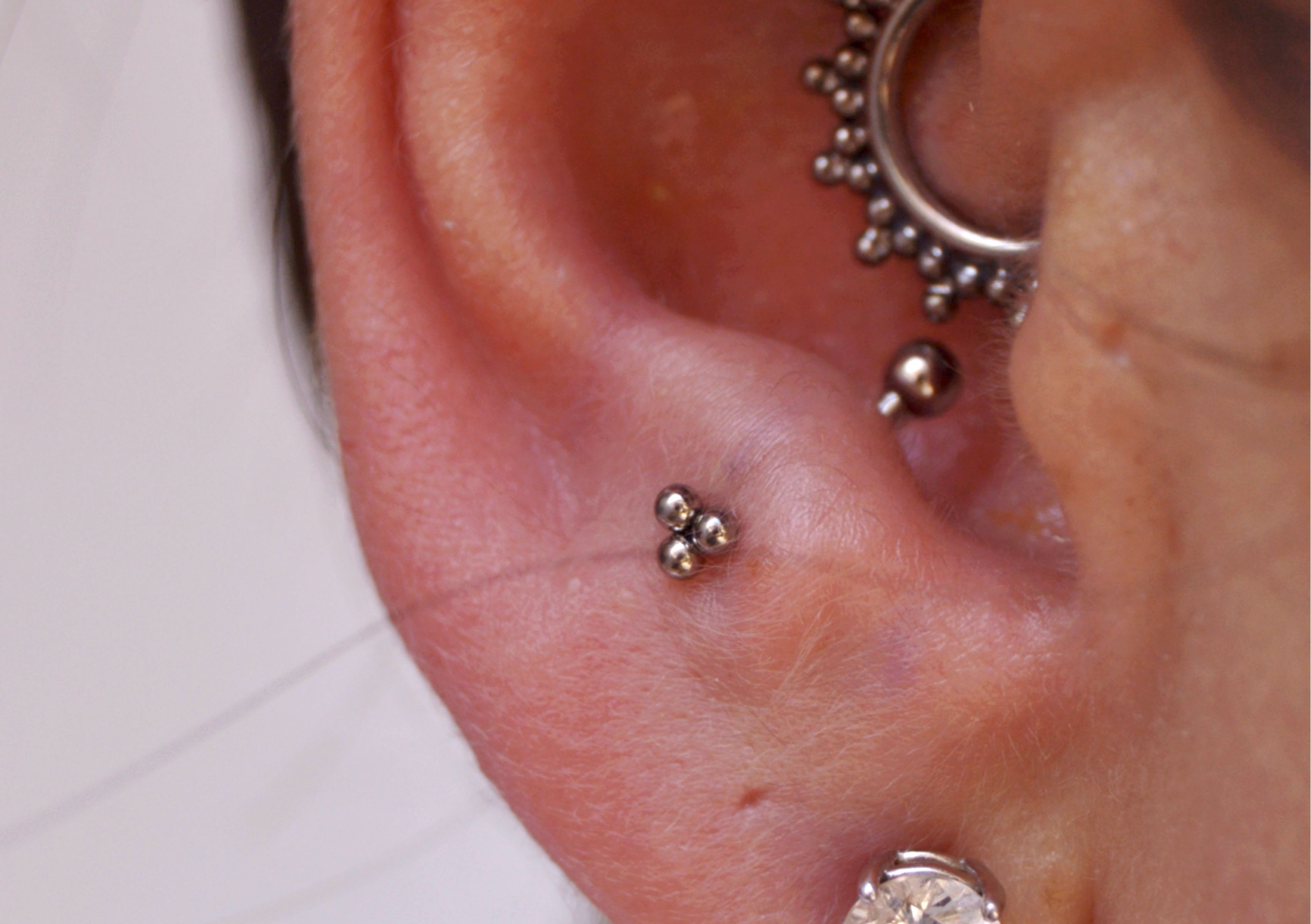 Anti Tragus