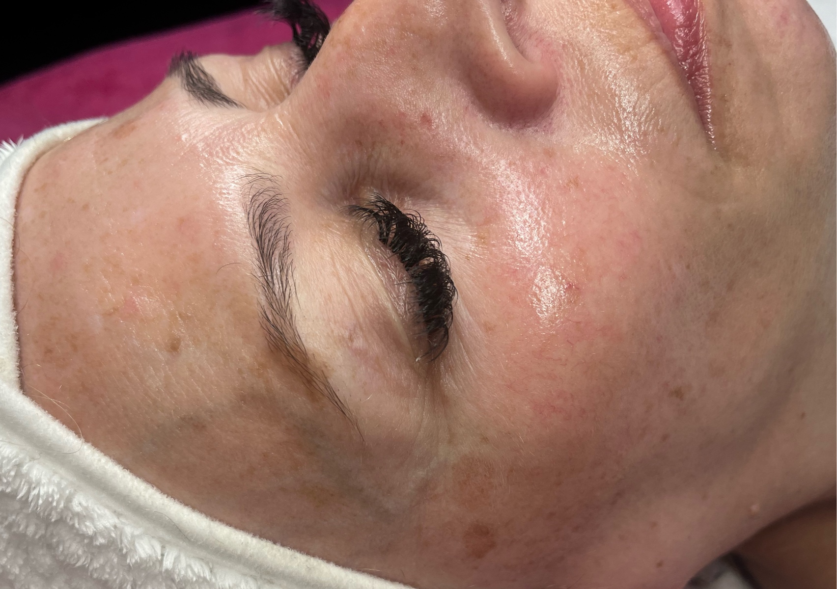 Anti- Ageing Facial