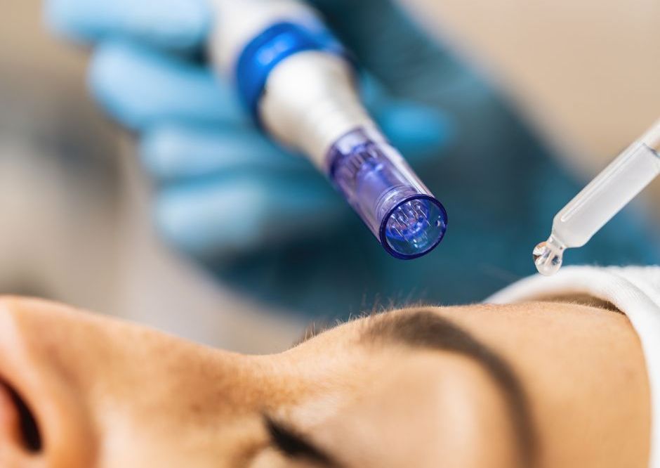 CIT Advanced Microneedling